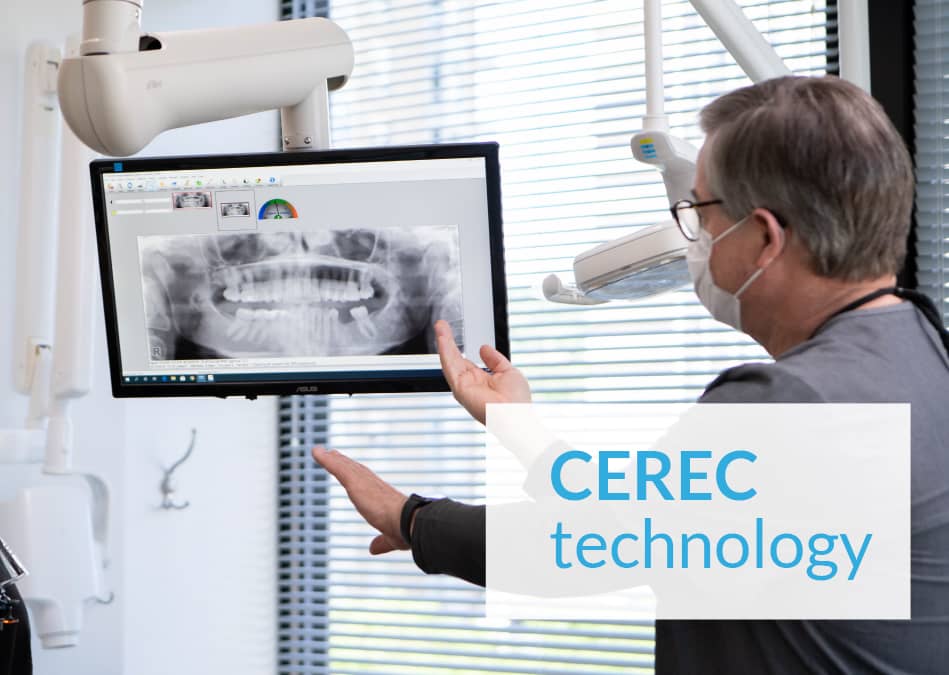 CEREC Technology