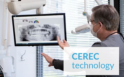 CEREC Technology